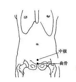 子宫下垂艾灸的正确方法,子宫下垂用艾灸坐垫怎么样