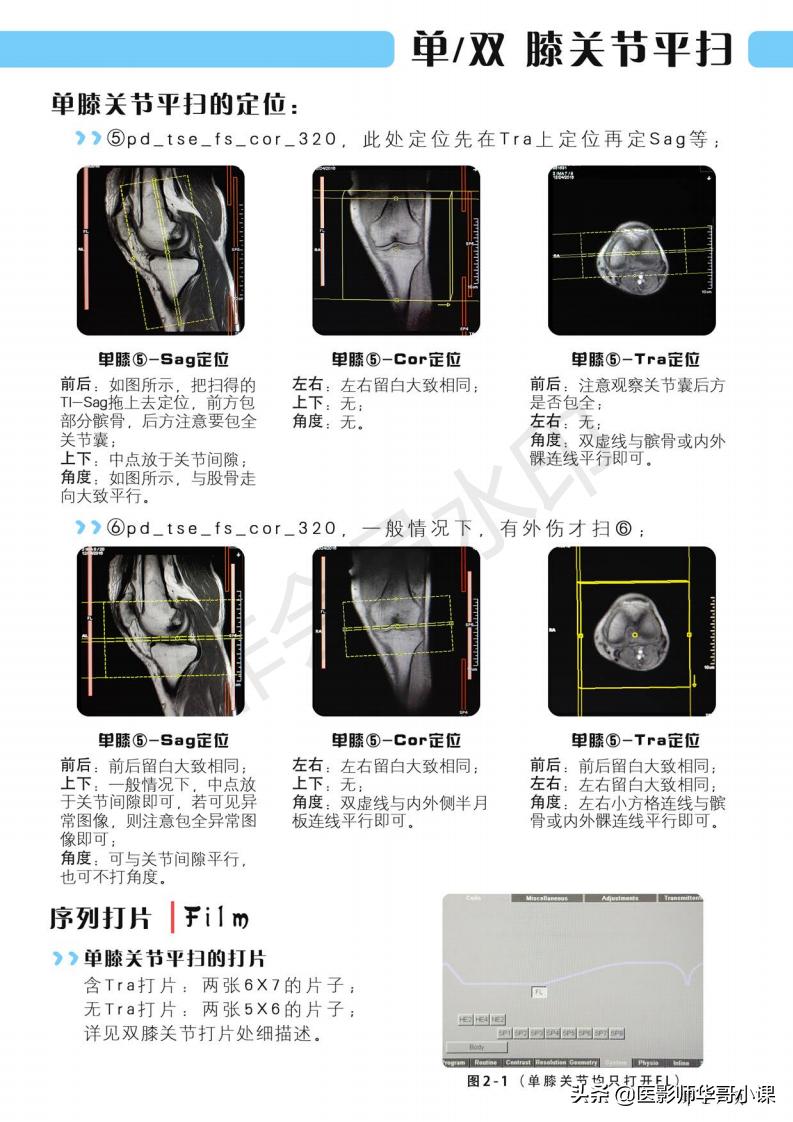 磁共振扫描技术西门子,西门子磁共振最新操作界面