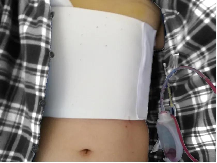 两个乳房发育不一致正常吗,乳房发育后才长腋毛正常吗