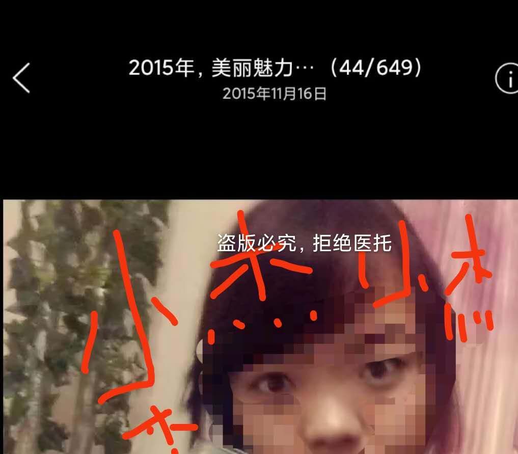 长沙隆鼻1-7天恢复过程图,长沙做假体隆鼻手术多少钱