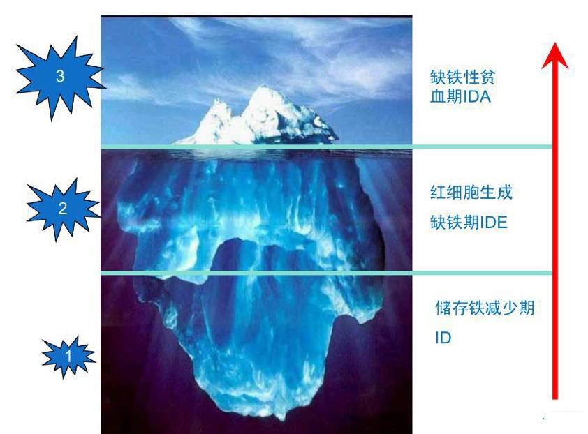 宝宝缺铁更可怕,宝宝缺铁和缺钙怎么补