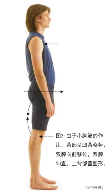 怎么缓解腘绳肌紧张,缓解腿部肌腱酸痛