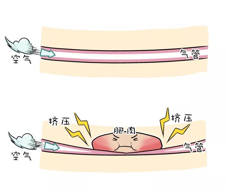 舍友打呼用音响,舍友打呼很大声我要怎么入睡