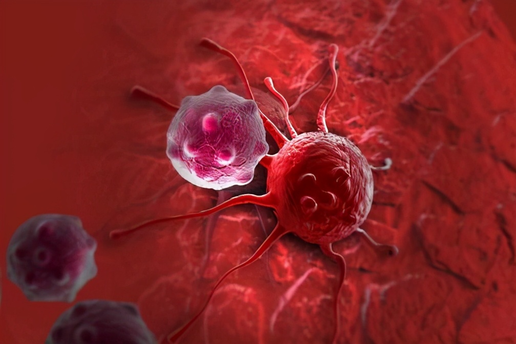 癌症复发后转移，还能救吗？医生直言：4个方法或能救上一命