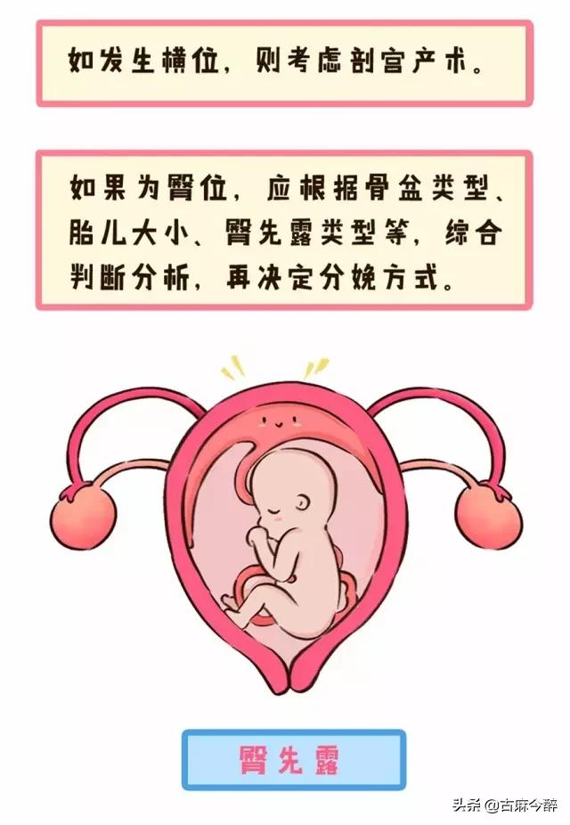 一分钟看懂孕检b超图,一秒教你看懂孕检化验单