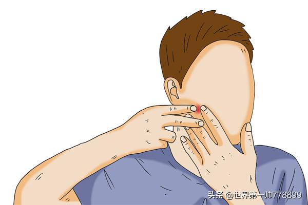 鼻子红红的一挤有白色分泌物,鼻子两边一挤很多白的分泌物