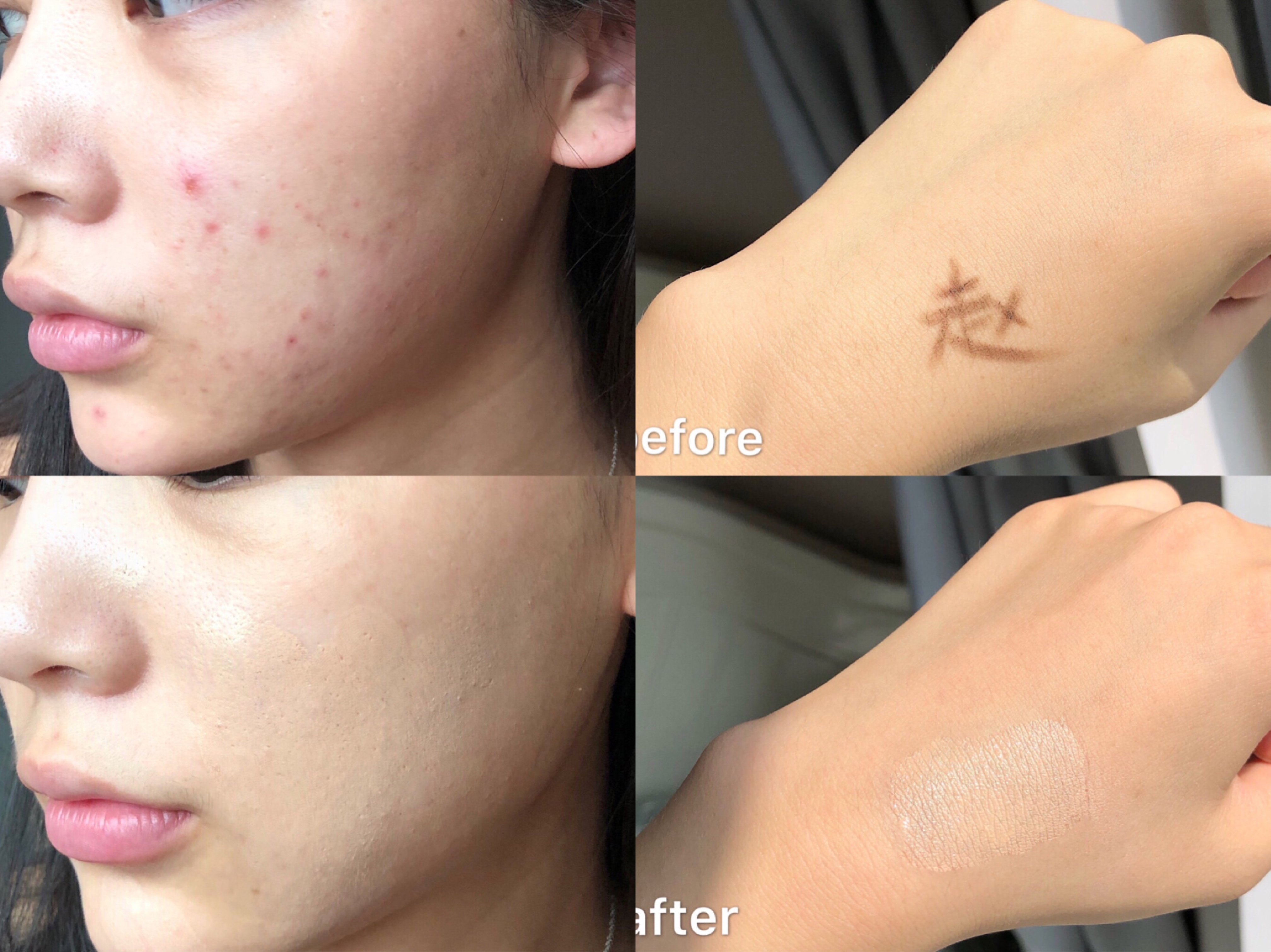 黛玛蔻遮瑕膏遮盖斑点无美颜滤镜,黛玛蔻遮瑕霜可以遮纹身嘛