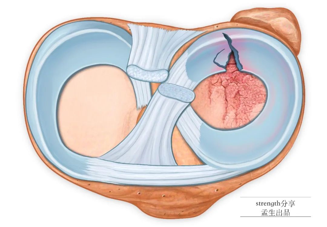 什么样的运动不伤骨头——越练越伤，了解你的软骨