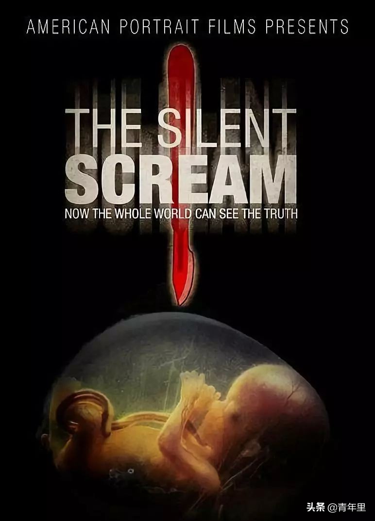 男性避孕针国内有了吗,男性避孕针首例