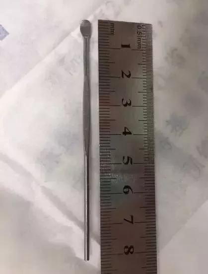 熊孩子用弹弓射人被垃圾车送走,9岁男孩把飞镖塞下来