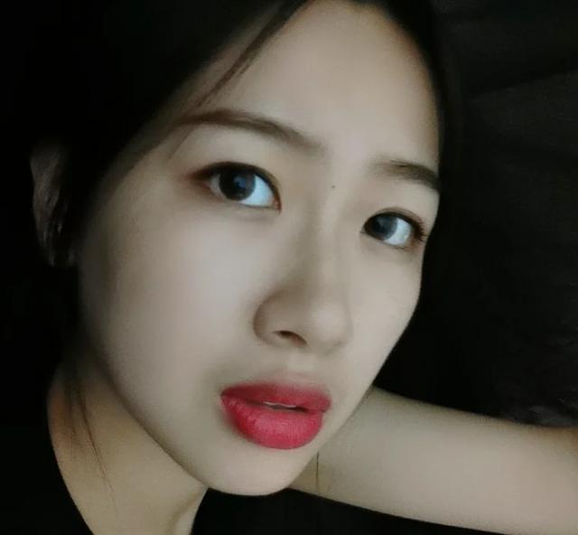 嘴唇厚黑怎么改善,嘴唇很厚而且还翘怎么办
