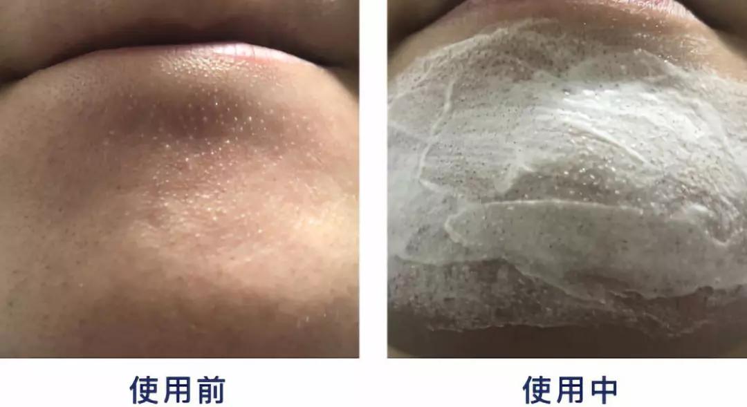 韩国超火品牌，明星都在安利，堪比CPB洗面奶！薛凯琪把它作为C位