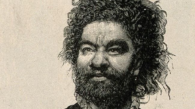 金毛狮王头发是什么根,金毛狮王的头发怎么处理