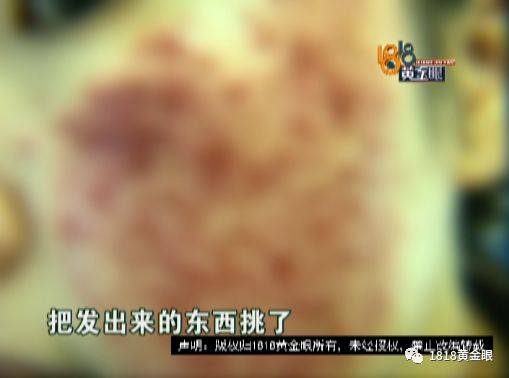 扎针放血真是痛,皮下淤血肿了扎针放血