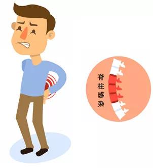 脊柱感染也可以微创治疗