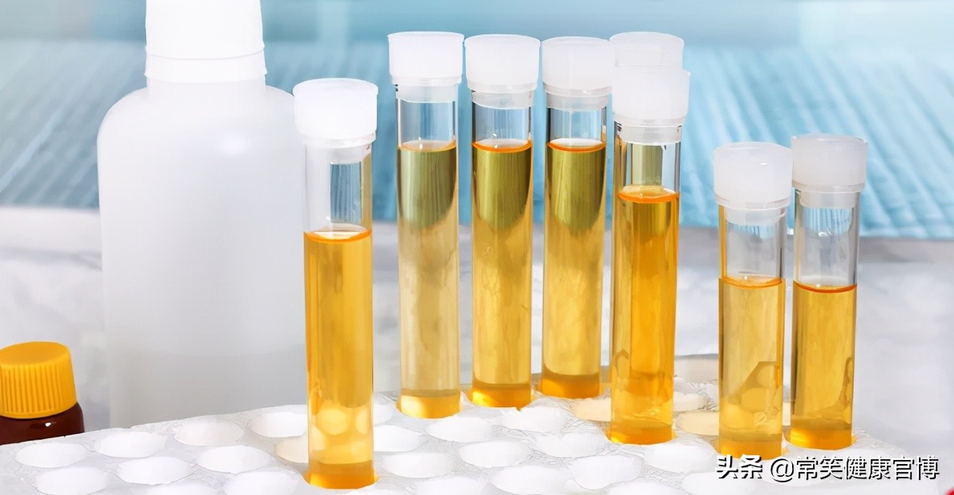 尿液淡黄色和深黄色的对比,尿液黄色和淡黄色的区别