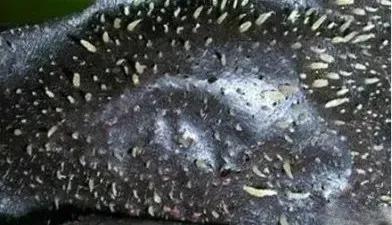 黑头用黑头贴去不掉怎么办,白糖去黑头的正确方法