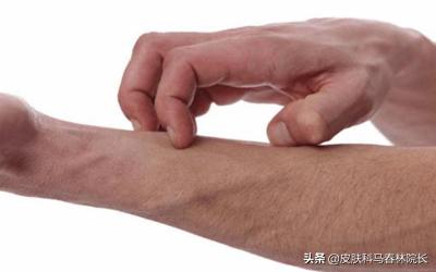 紫癜皮肤病饮食禁忌啥,各种皮肤病患者的饮食禁忌