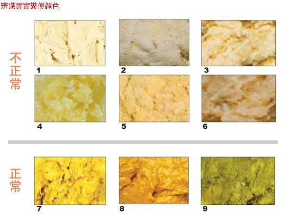 宝宝大便颜色看状况,儿童便便颜色看出健康状态