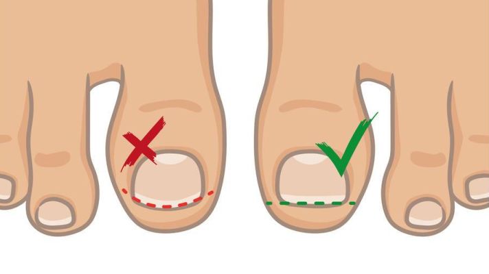 指甲上月牙少是什么问题,指甲月牙少了怎么回事