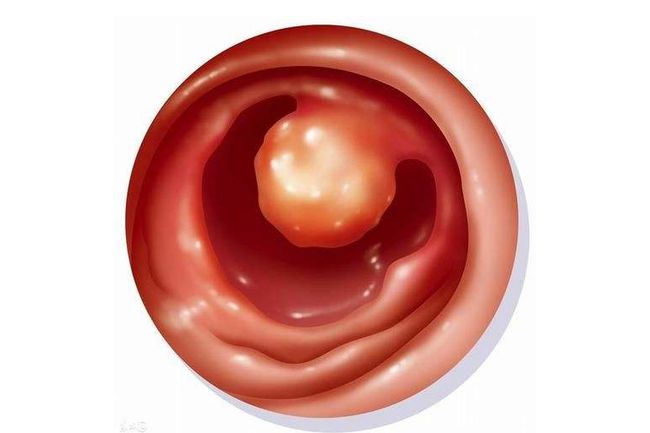 别人坐过的热板凳能立即去坐么,别人坐过的热凳子会有传染病吗