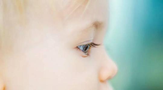 8个月宝宝倒睫严重怎么办,宝宝倒睫怎么治疗成功