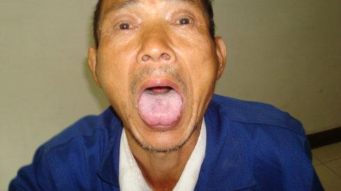 为啥有些人嘴唇是黑紫色的,为什么有的人嘴唇颜色很深很暗