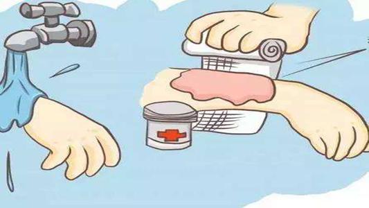 孩子烫伤10小时后起泡,孩子烫伤后多久没有痛感