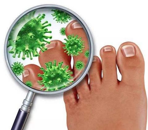 脚后跟和脚丫干裂药膏推荐,脚后跟干裂脚丫烂掉