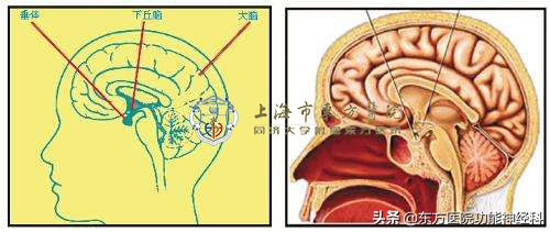 精神分裂症最新治疗药物,精神分裂症不治疗会怎样