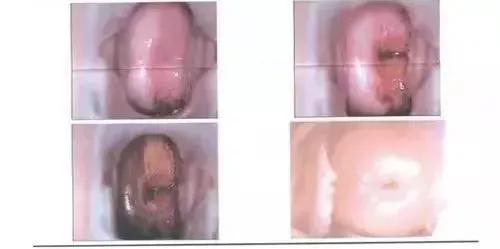 这种专坑女性的「妇科病」，其实根本不用治