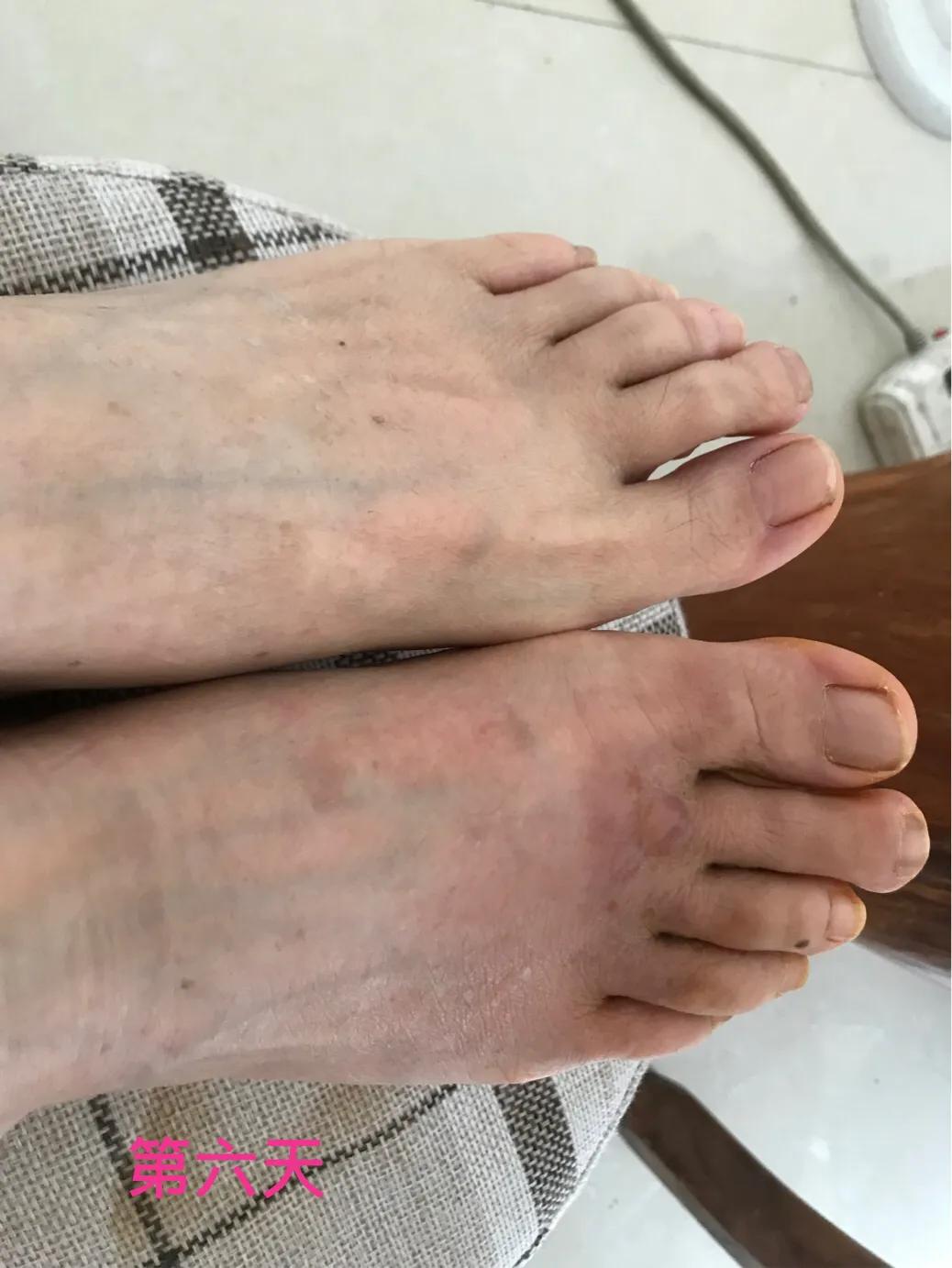 自己用中药熬的面膜靠谱吗,自己用中药做的面膜好吗