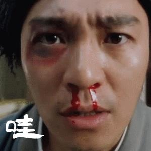 孩子立秋就犯鼻炎吃什么药,孩子沙鼻子怎么根治