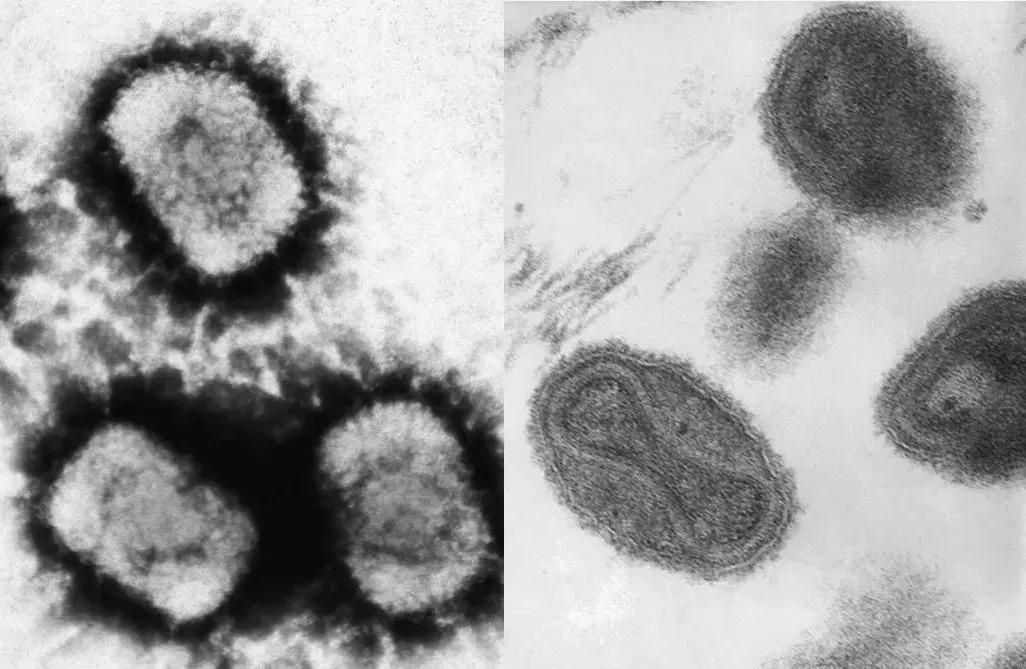 他靠一场“瘟疫”登上皇位，成就千古一帝，并险些改变清朝国运？