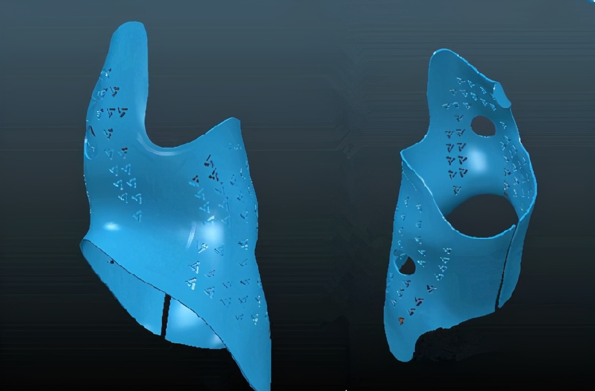 脊柱侧弯戴矫正支具可以报销吗,脊柱侧弯支具治疗的流程