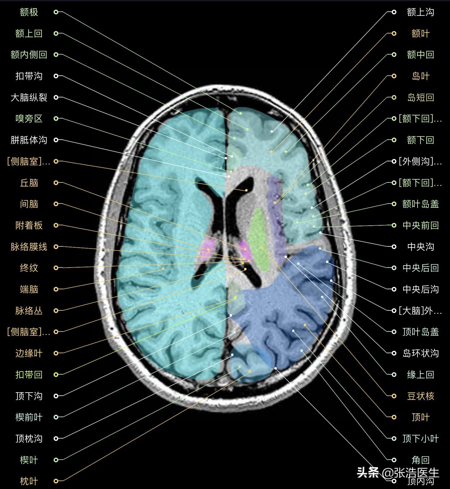颅脑mri解剖影像检查是什么意思,颅脑mri断层解剖视频课件