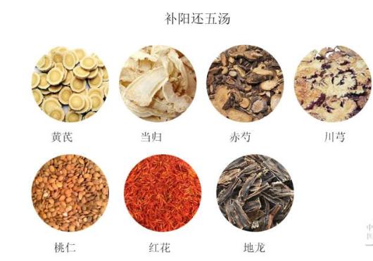 国医大师邓铁涛治62种病的经验方,邓铁涛治疗中风医案