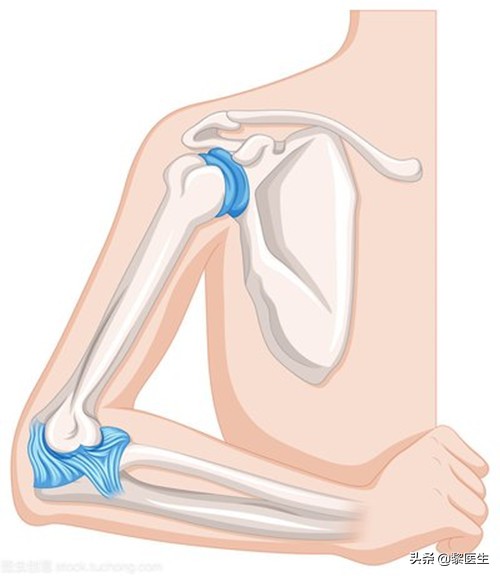 肘关节脱位x片都可以看出来吗,肘关节后脱位的特征表现是什么