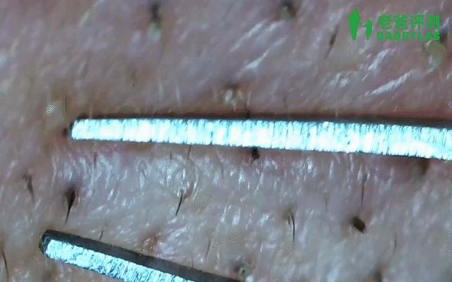 正确科学的去黑头方法一次说清楚,正确的去黑头的方法在这里