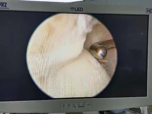 泗阳治疗脚崴的地方,泗阳哪家医院治疗脚扭伤