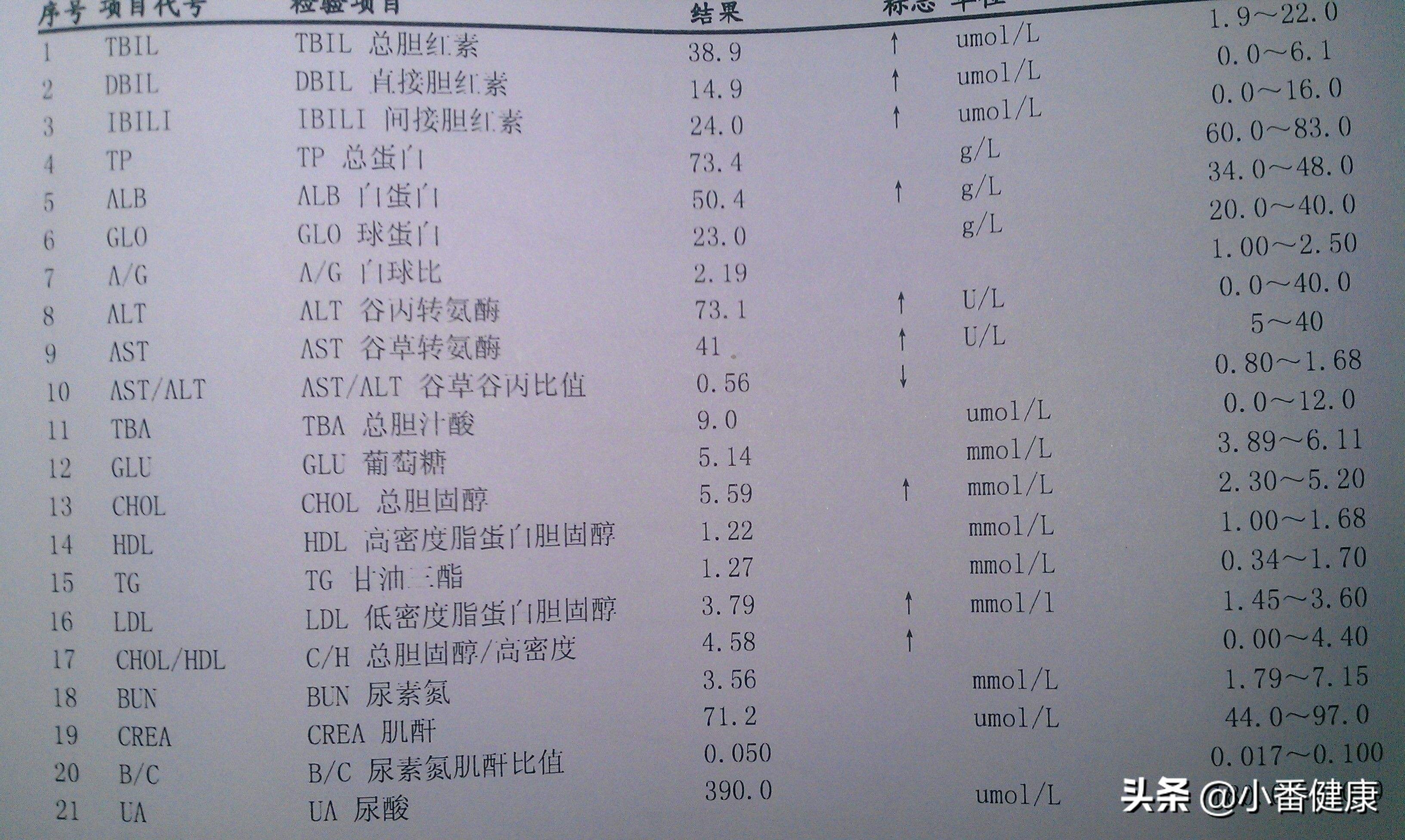 乙肝两对半报告,第145阳性,为乙肝小三阳
