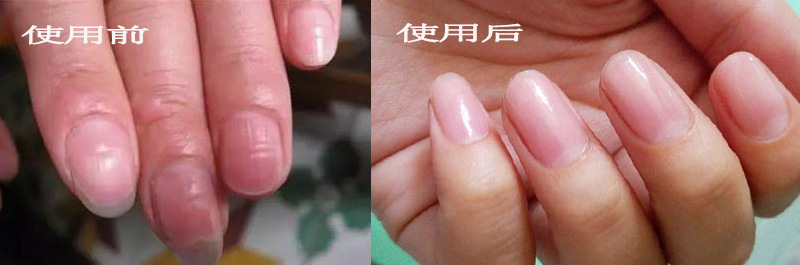 易劈易断还分层？美国专业沙龙修复甲油，给“病甲”快速“整容”