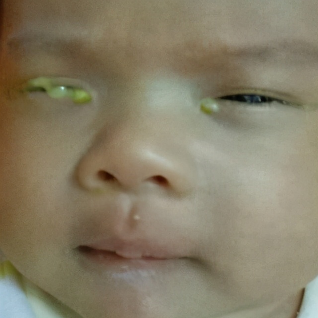 小孩儿眼屎黄多还咳嗽喝什么药,小孩黄眼屎多是什么原因引起的