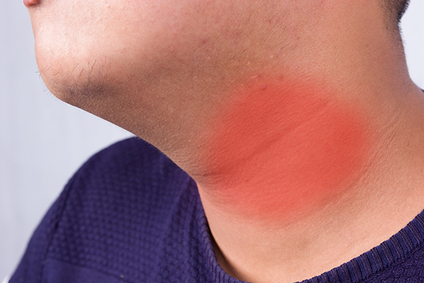 甲状腺一直不治会引发什么病,甲状腺有问题是大问题还是小问题