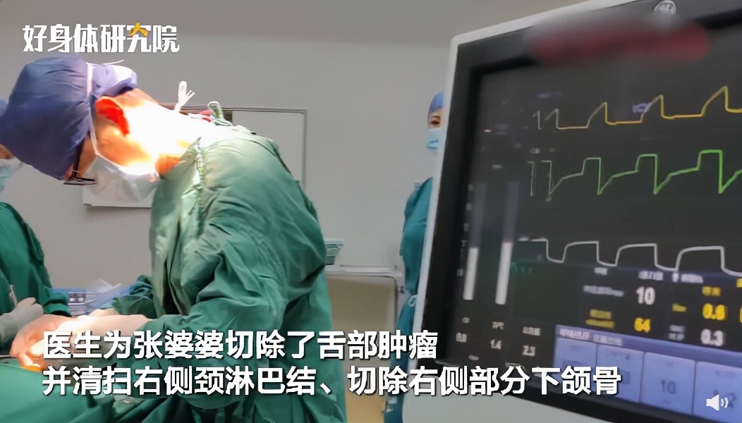 口腔溃疡长时间不好一定是舌癌吗,几乎每天都有口腔溃疡是舌癌吗