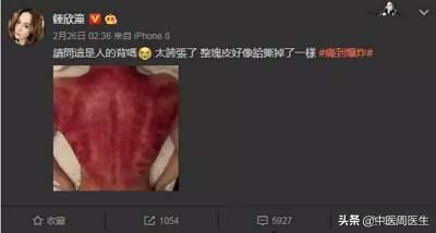 背上刮痧刮出很多红痧是什么原因,胸前刮痧出痧原因分析视频