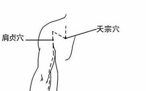 肩颈酸痛怎么缓解按摩治疗肩颈痛,肩颈酸痛的原因及解决方法