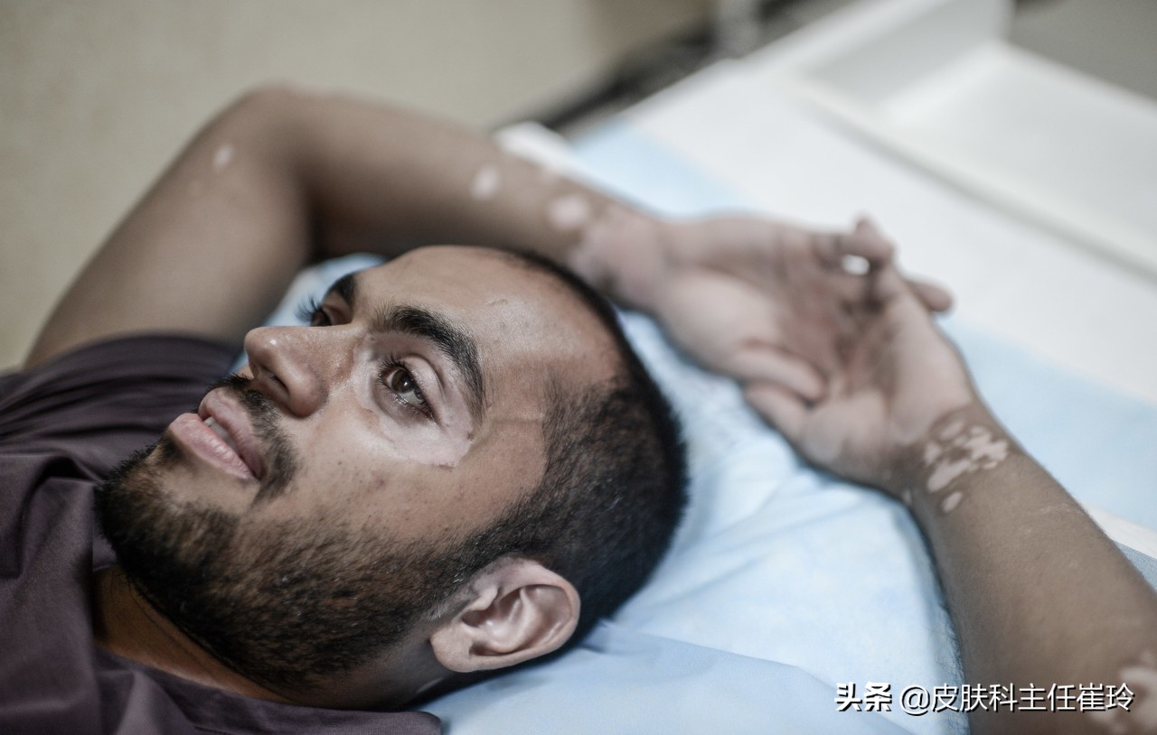 青少年长色斑怎么办,声带白斑注意事项