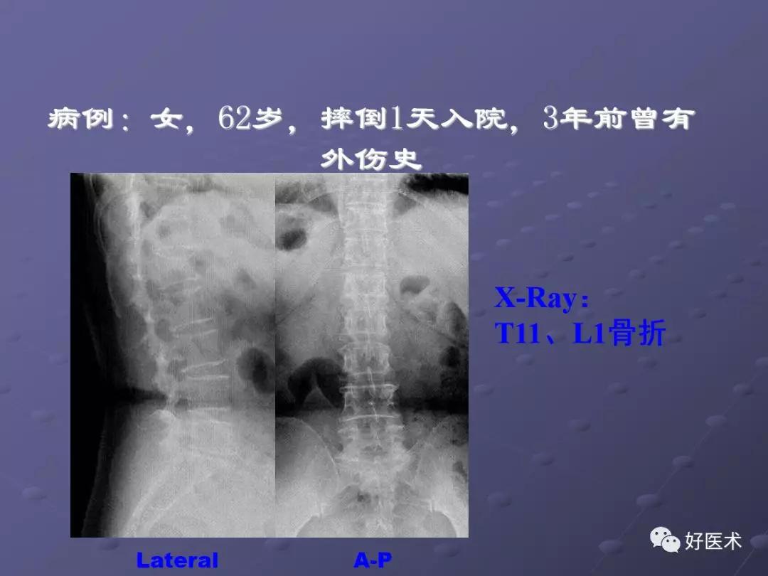脊柱mri有哪些特点,乳腺疾病的mri诊断及鉴别