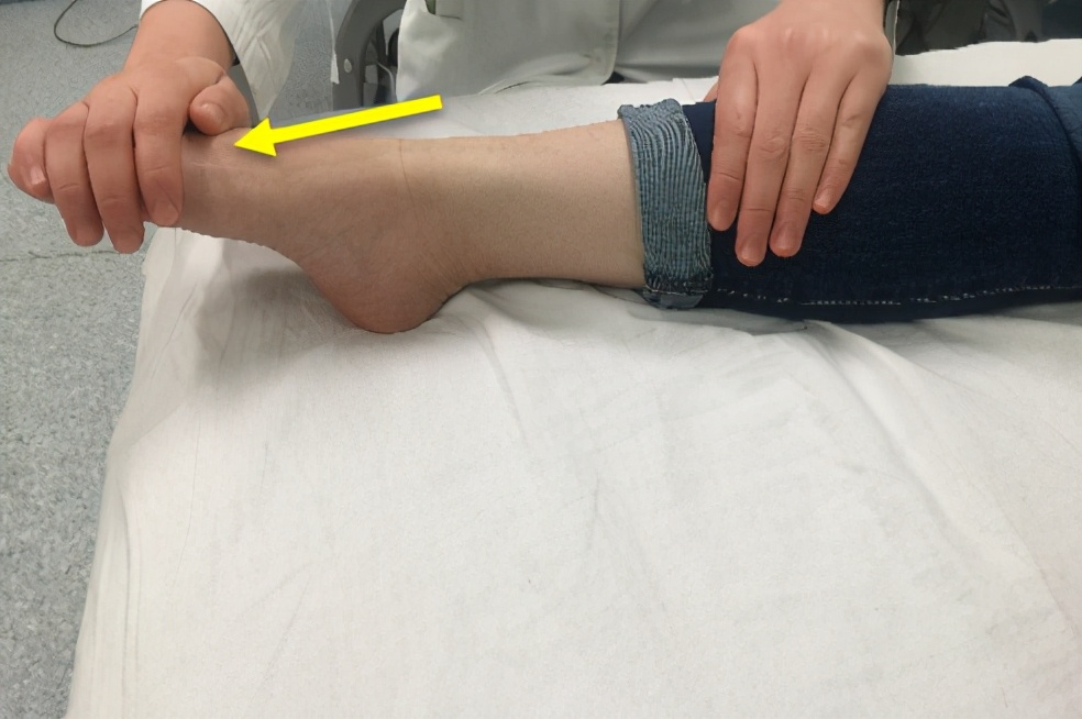 打篮球崴脚了怎么快速恢复3天,崴脚后怎么锻炼恢复快